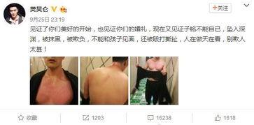 娱乐圈吃瓜熊婶,揭秘熊婶的吃瓜传奇  第1张